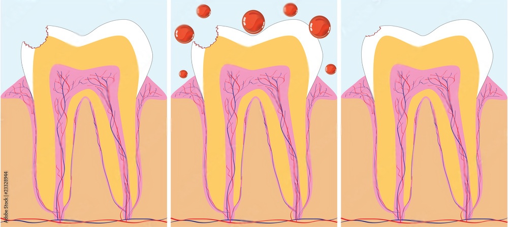 The importance of dental prophylaxis in preventing gum disease | Blog ...